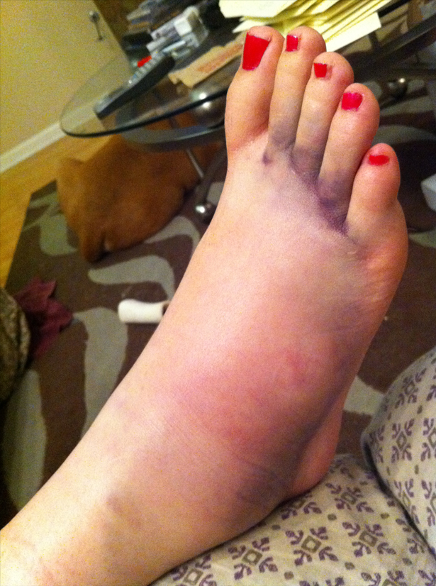 Horse_SteppedFoot