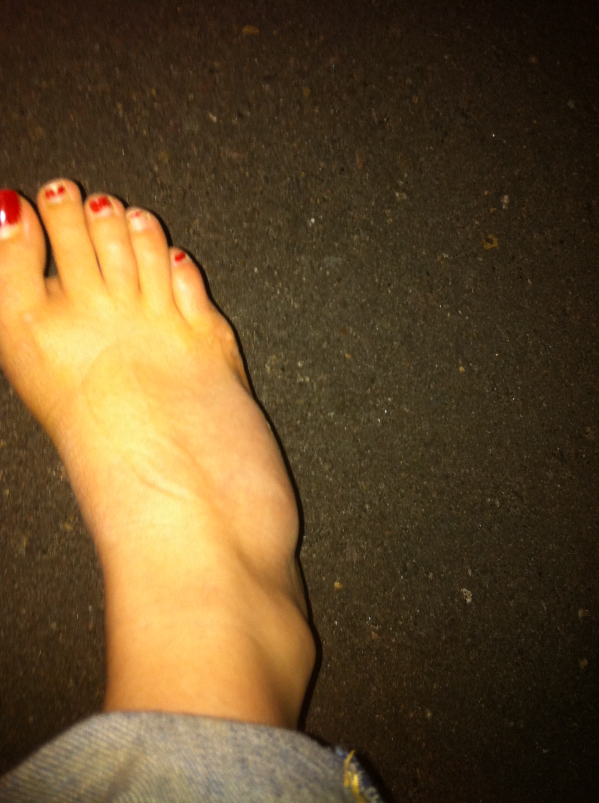Horse Stepped On Foot