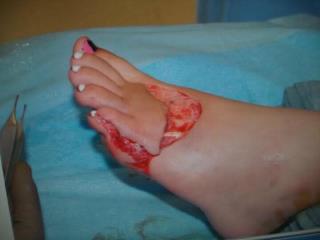 www.imgur.com - with horse shoes