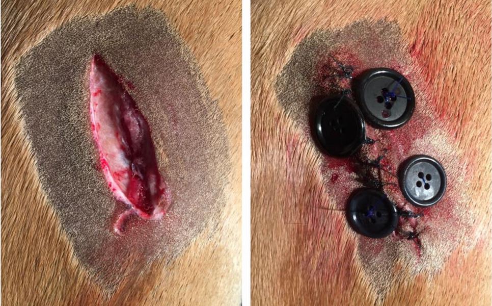 button-sutures-2